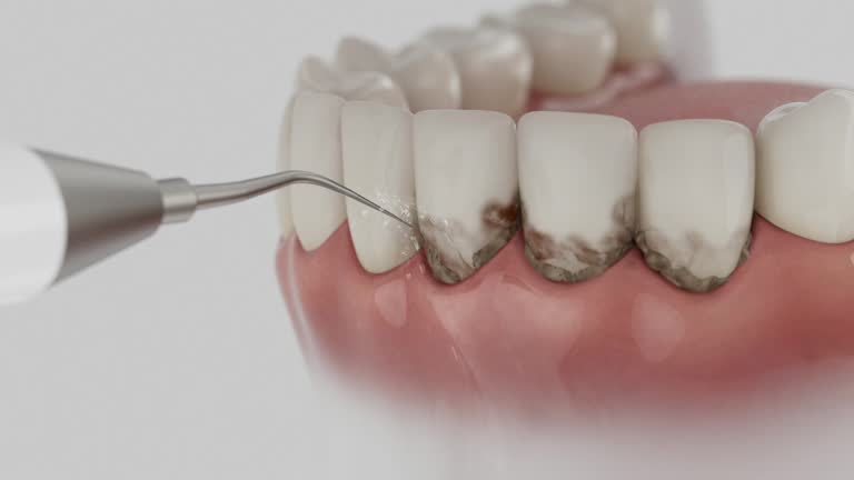 Trusted Teeth Cleaning And Checkup service in Midvale, UT - Dentist Open Now
